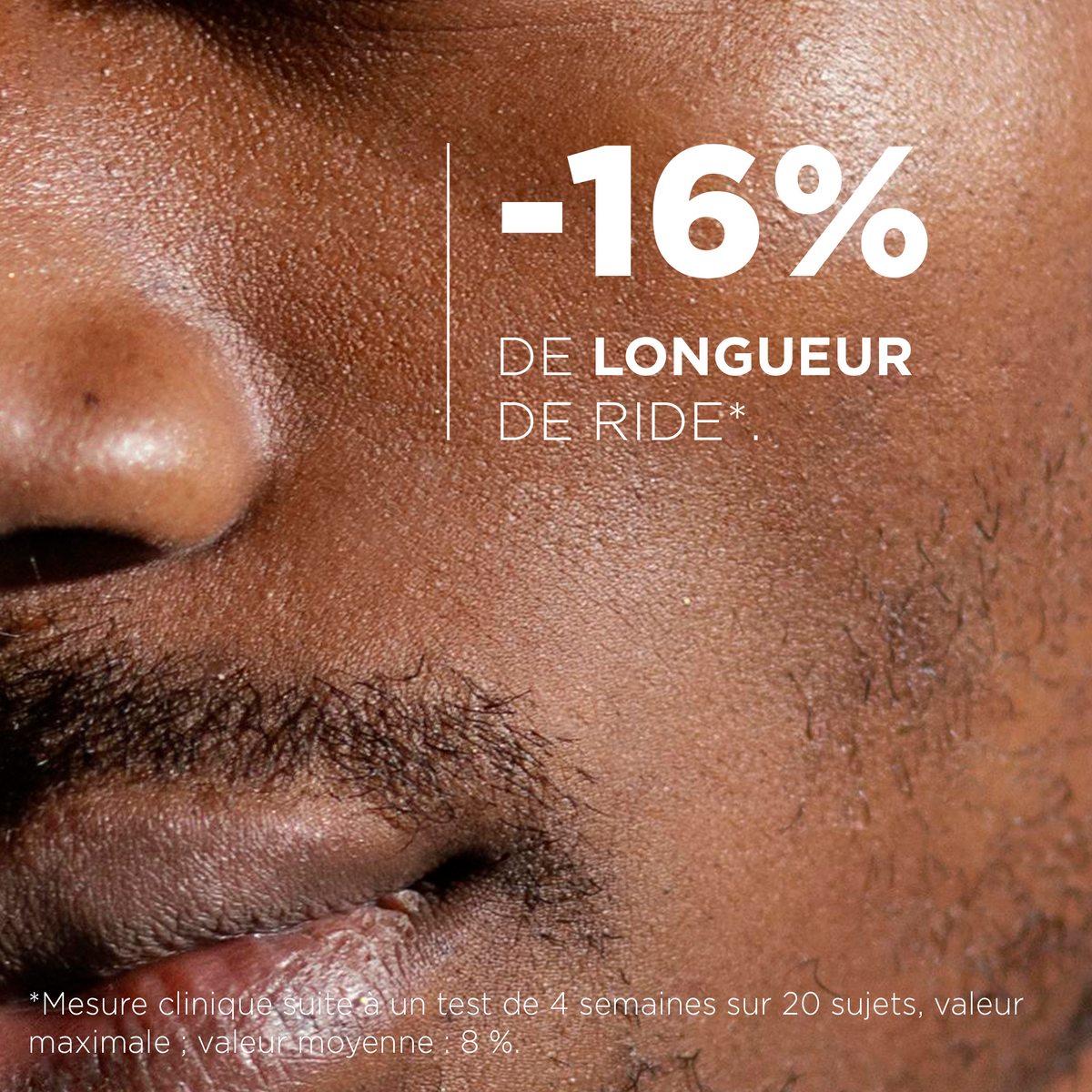 Mesure clinique : jusqu'à -16 % de longueur des rides