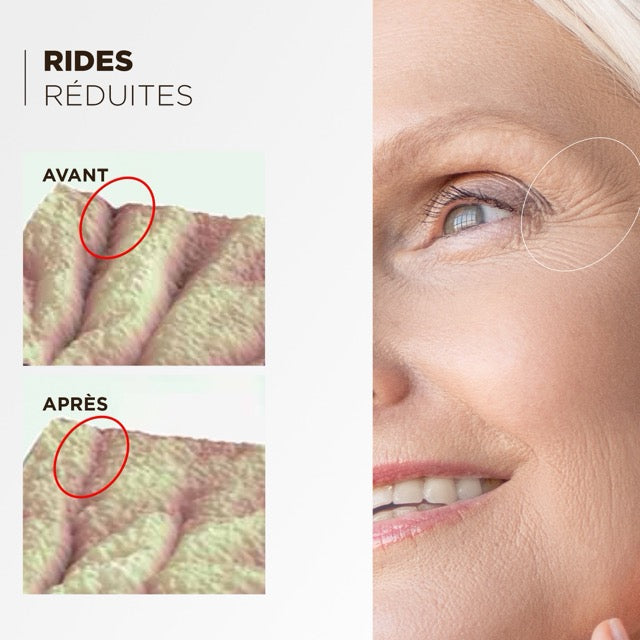 Le Contour Des Yeux Concombre