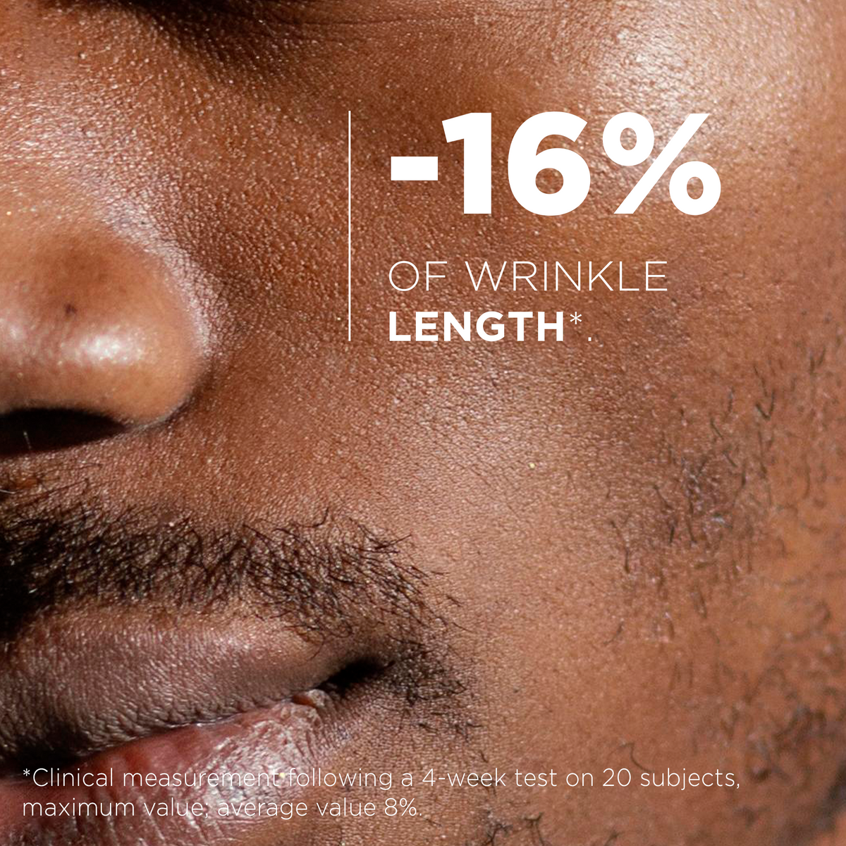 Clinical measurement: up to -16% wrinkle length
