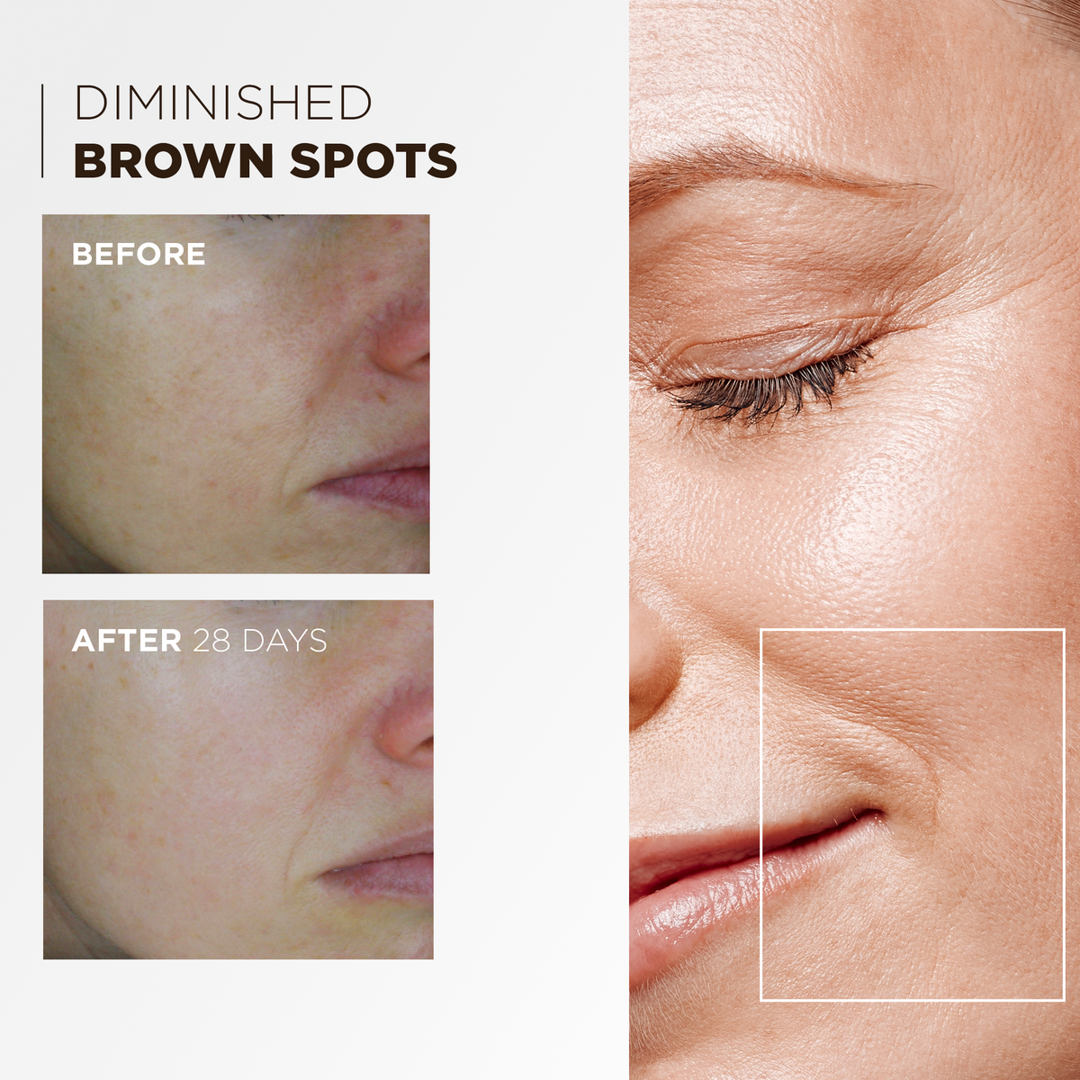 Before and after 28 days: diminished brown spots