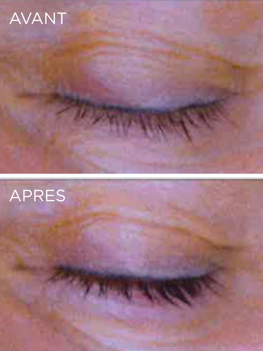 Résultats cliniques du Booster Cils & Sourcils HUYGENS